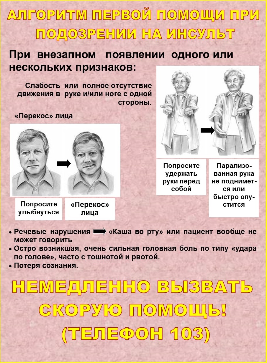 инсульт1